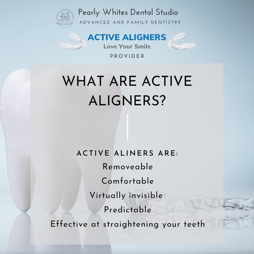 Active Aligners